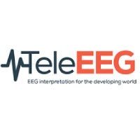 Teleeeeg